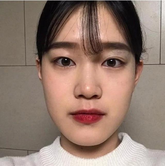 如何消除双下巴让脸型更好看,下巴松弛造成的双下巴面相