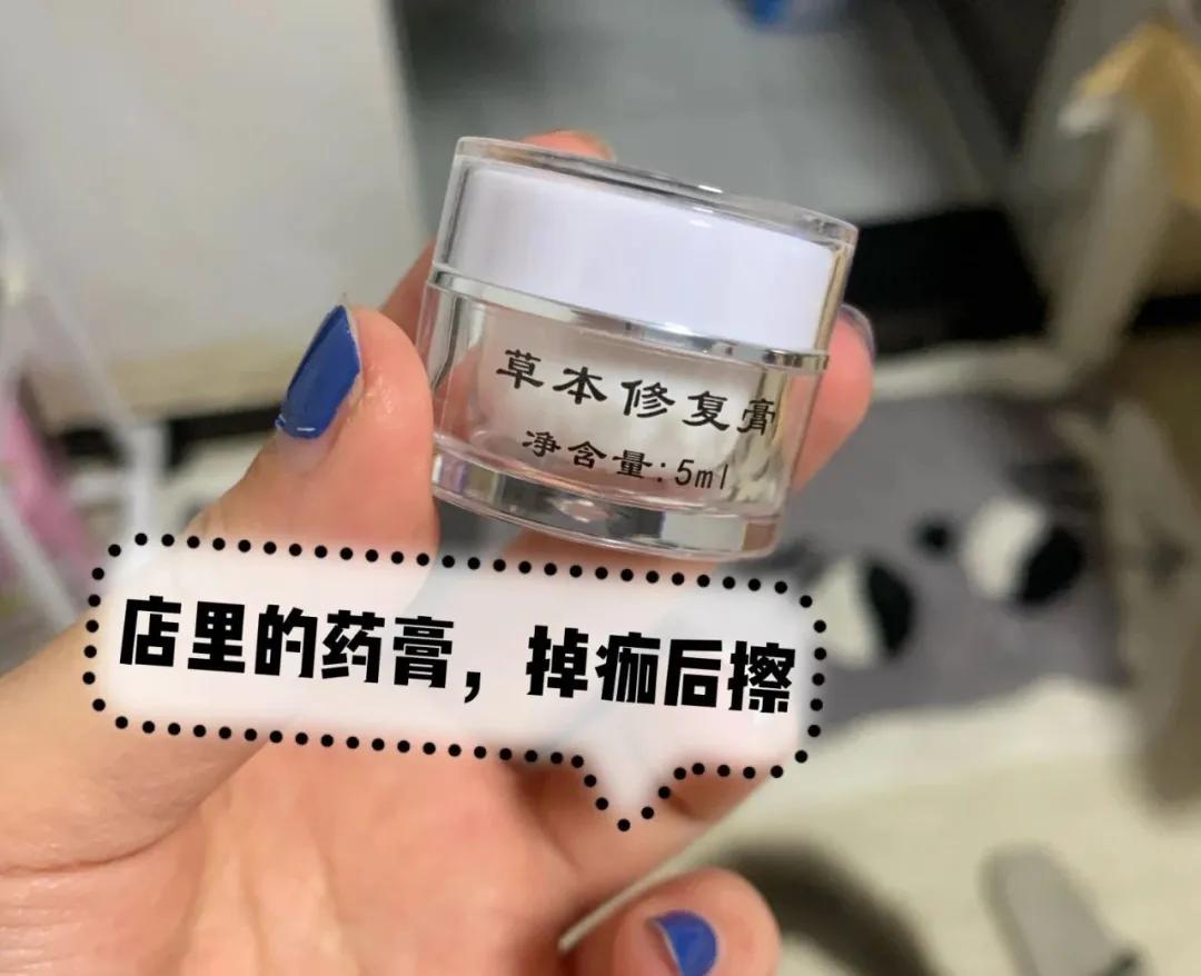 痣多适合什么点痣方法,点痣小妙招一秒点好一个美人痣