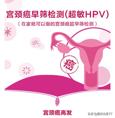 女性做宫颈癌筛查需要多少钱,65后需要做宫颈癌筛查吗