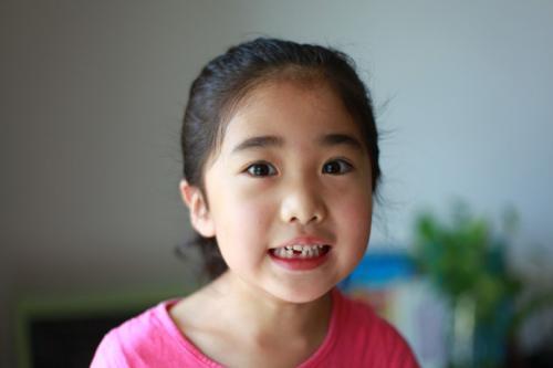 六岁孩子要换牙需要注意什么,七岁小朋友换牙需要注意什么