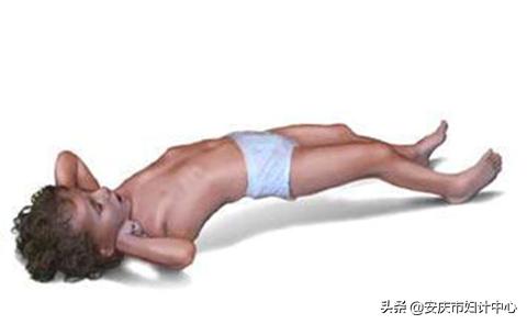 中暑热惊厥,中暑惊厥是什么症状