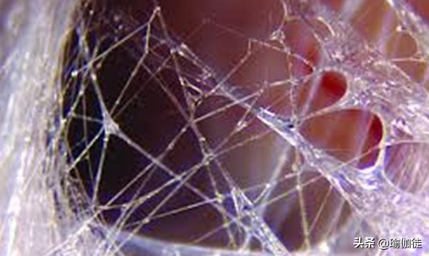 肌筋膜链是什么样的,四个方面告诉你肌筋膜放松的好处