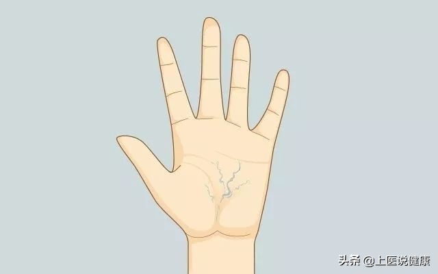 身体上出现的青筋是怎么回事,身体上的青筋明显是怎么回事