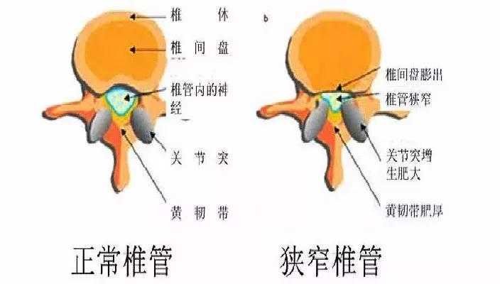 腰疼直不起来腰是什么原因引起的,青少年两侧腰疼是什么原因引起的