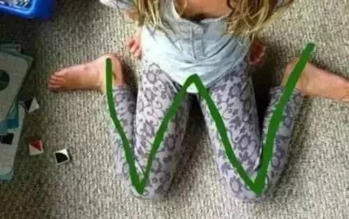 跑姿错误的后果,跑姿十大常见错误