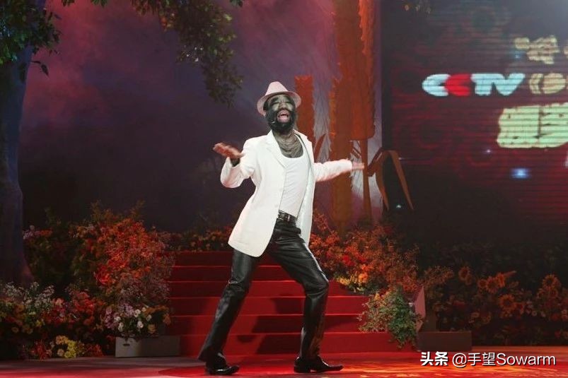 全世界体毛最多的人，是如何在歧视中逆袭为实力派歌手的？