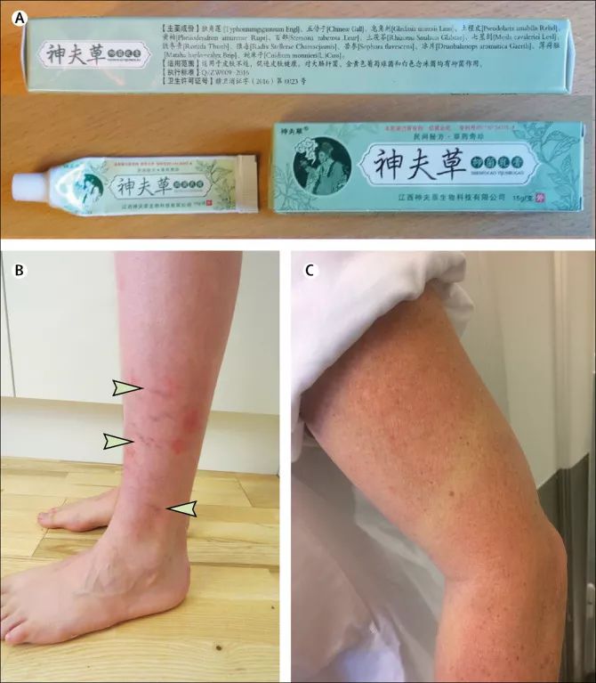 健康时报红霉素软膏,健康时报消毒产品