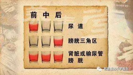 吃完火龙果血尿有哪些症状,血尿是不是火龙果造成