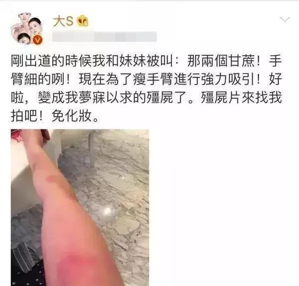 大s吃抗凝血剂好不好,大s吃的抗凝血剂美白是什么