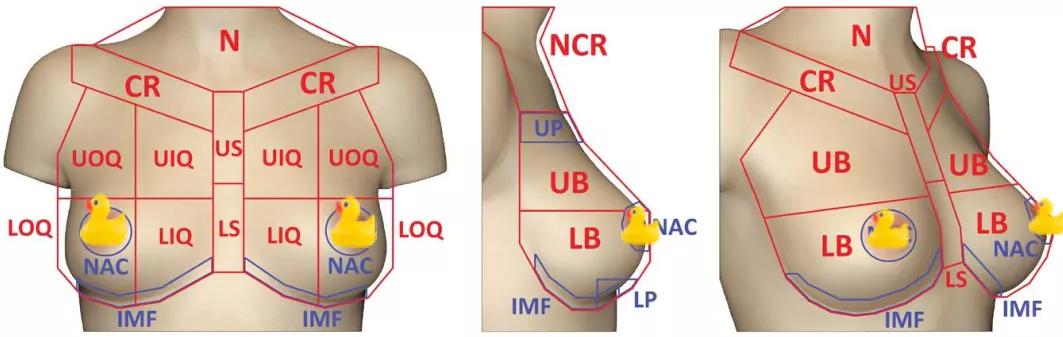 1招自测胸型教你1分钟选对,正确的胸型是怎么样的