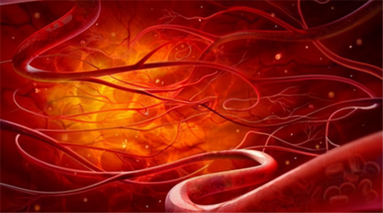 高血压腿麻会得脑梗吗,高血压会不会一直没感觉突然脑梗