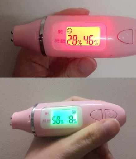 美容针美容的误区,为美而整容最后付出的代价