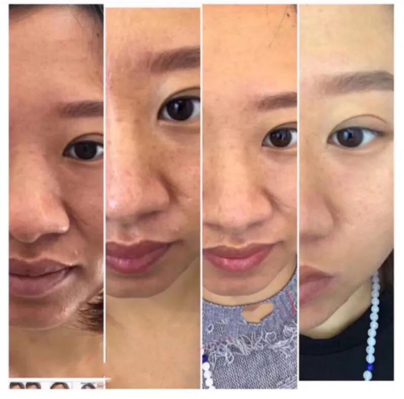 芳香世家小白瓶升级版有什么区别,芳香世家果饮小白瓶效果怎么样