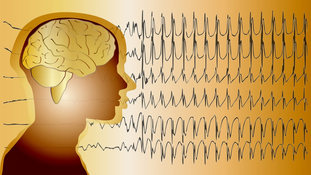 月经来癫痫病加重能预防吗,怎么预防癫痫病反复发作