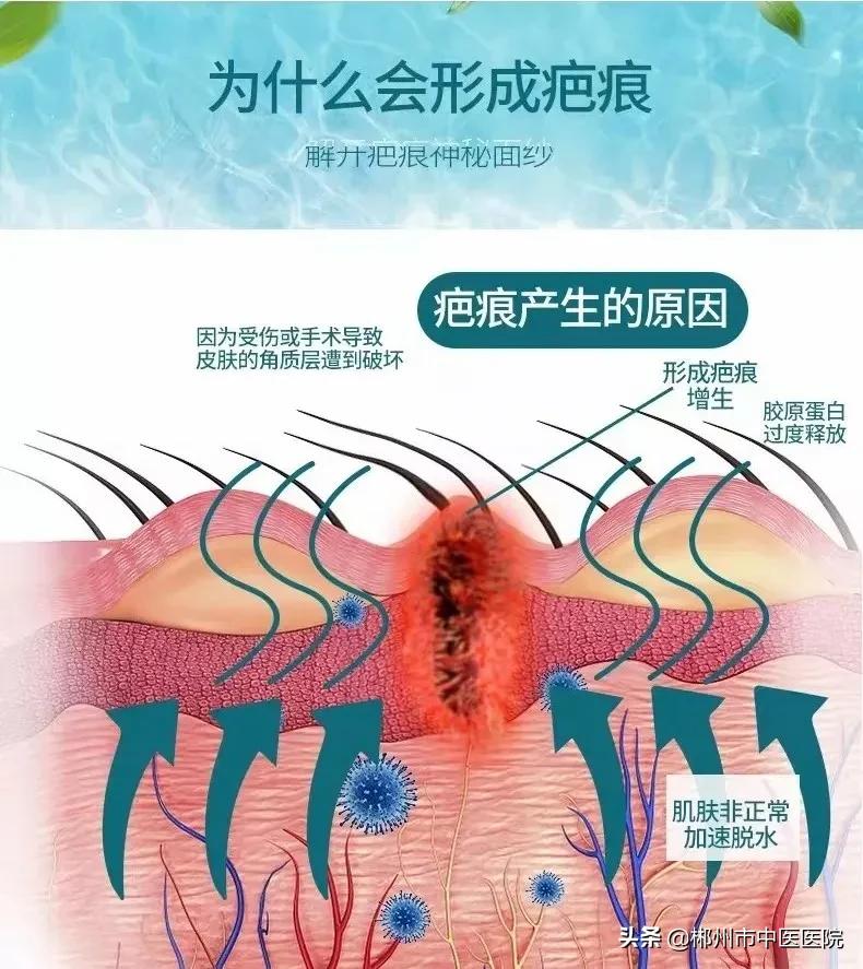 二氧化碳点阵激光真的有用,二氧化碳点阵激光真的有用吗