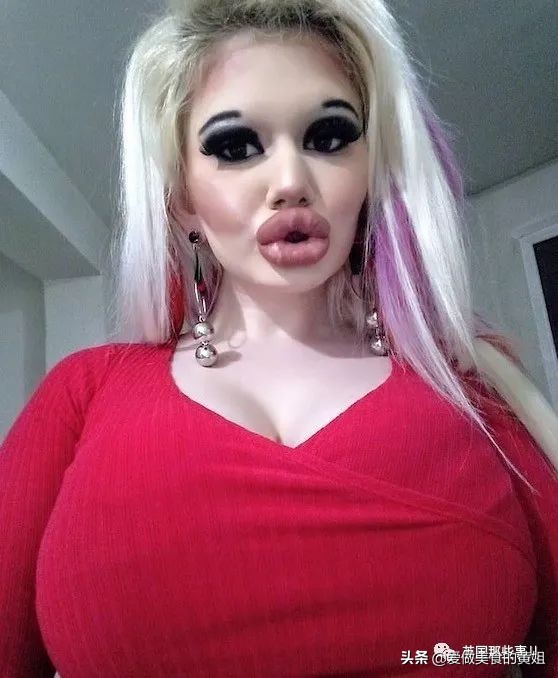 20次整容成功的女人,22岁女人做20次丰唇手术