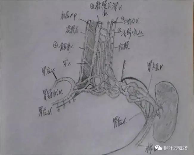 门脉高压的个体化治疗,肝前型门脉高压培训课程