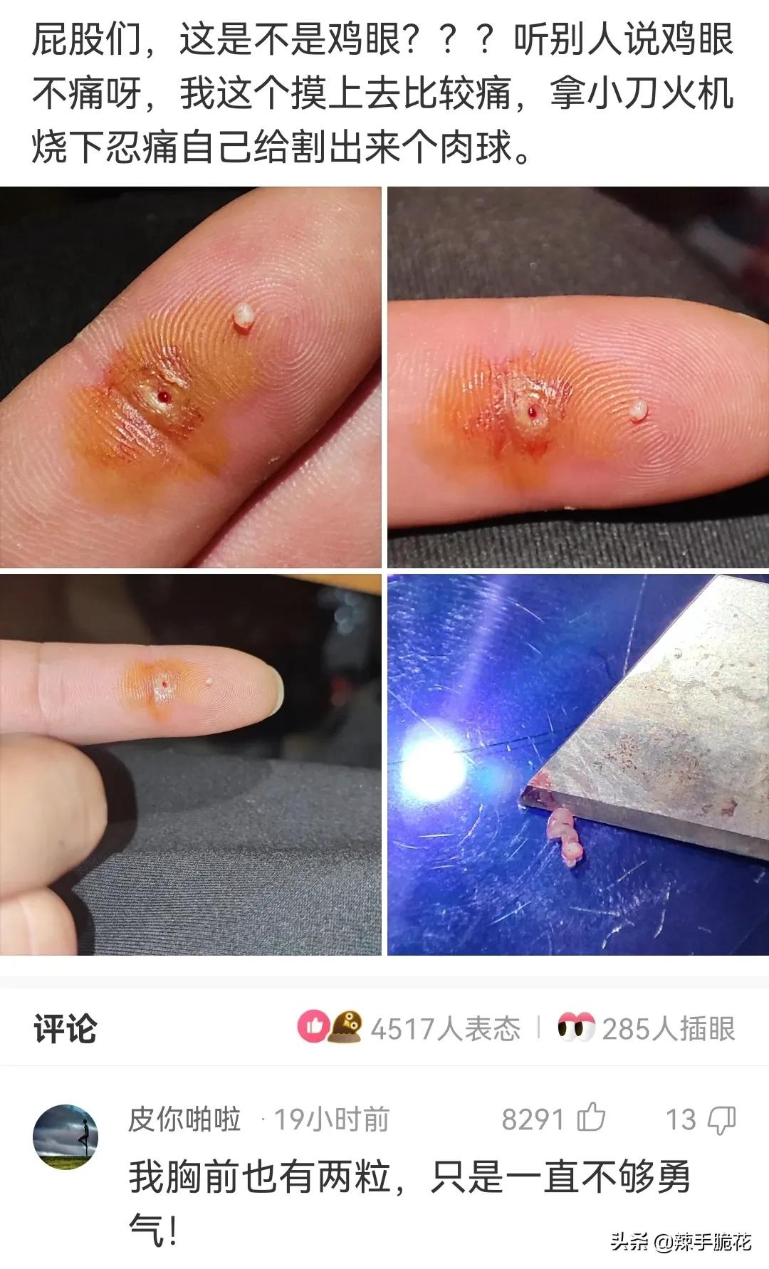 网友：像我这种没穿*裤内**的怎么进去？