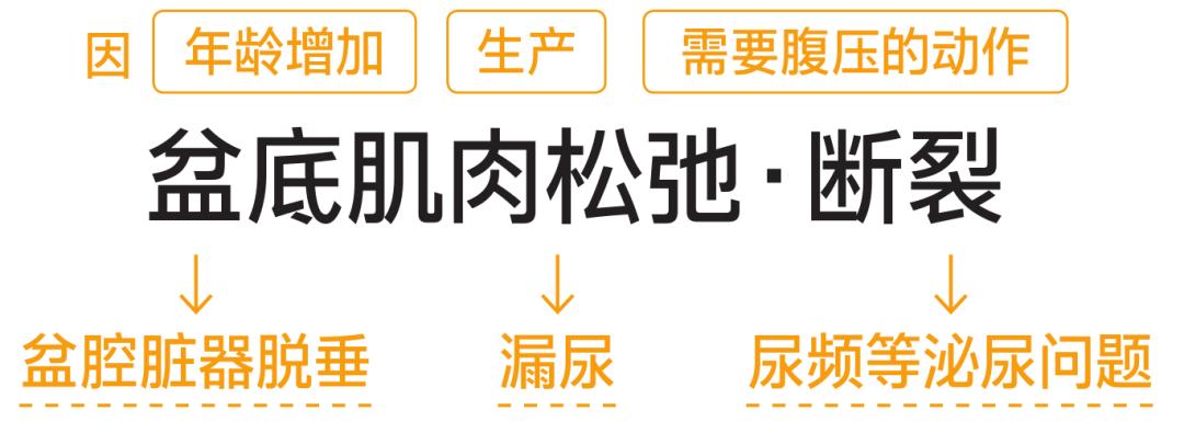 盆底肌训练器材可以改善漏尿吗,改善盆底肌漏尿