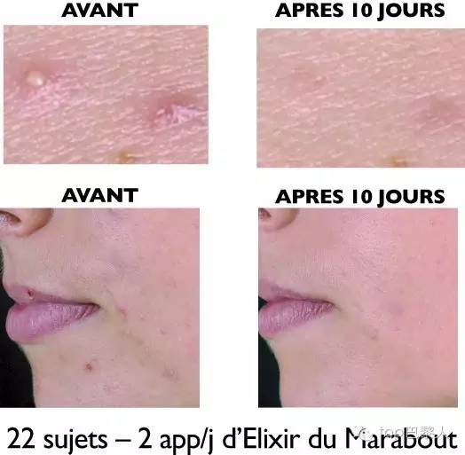 海淘大量护肤品,海淘护肤品攻略