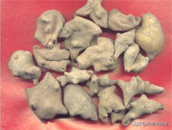 牙疼的治疗方法快速止痛睡不着觉,牙疼的原因及止疼方法