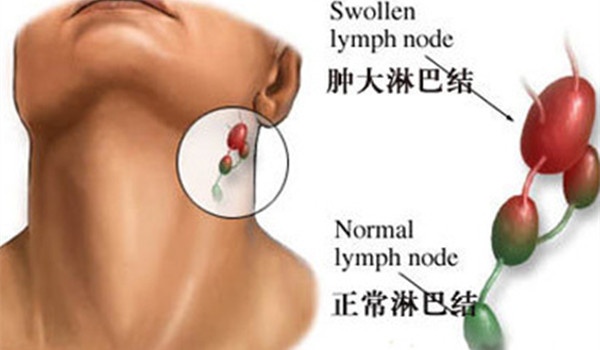 癌症辟谣,肿瘤患者辟谣