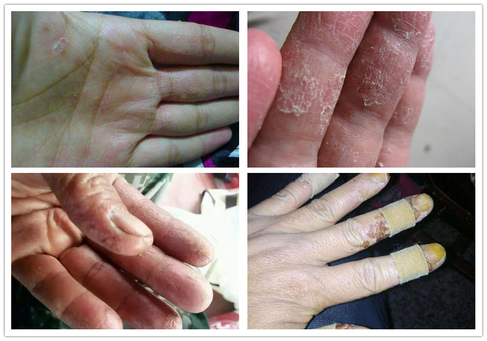 鍔ｈ川閽撻奔楗垫枡纰版按灏辨暎,鍔ｈ川楗垫枡