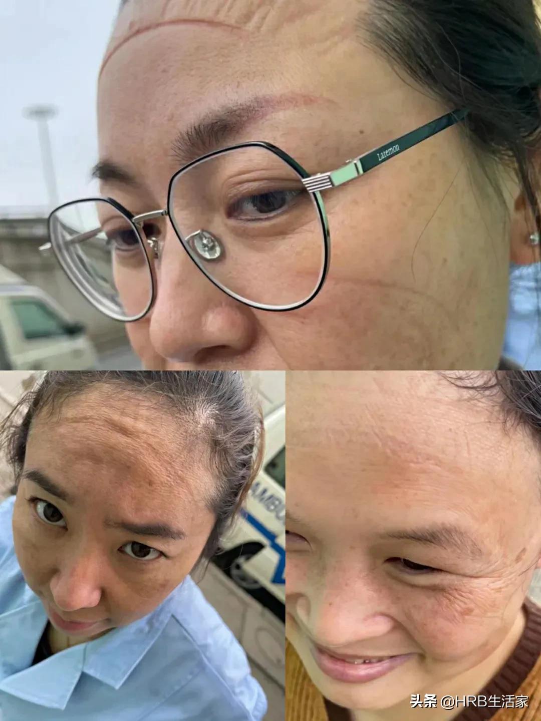 月圆日疫情来袭同战疫只争朝夕最美的“大白”——记哈市道外区人民医院大兴、南直社区核酸检测入户采样团队