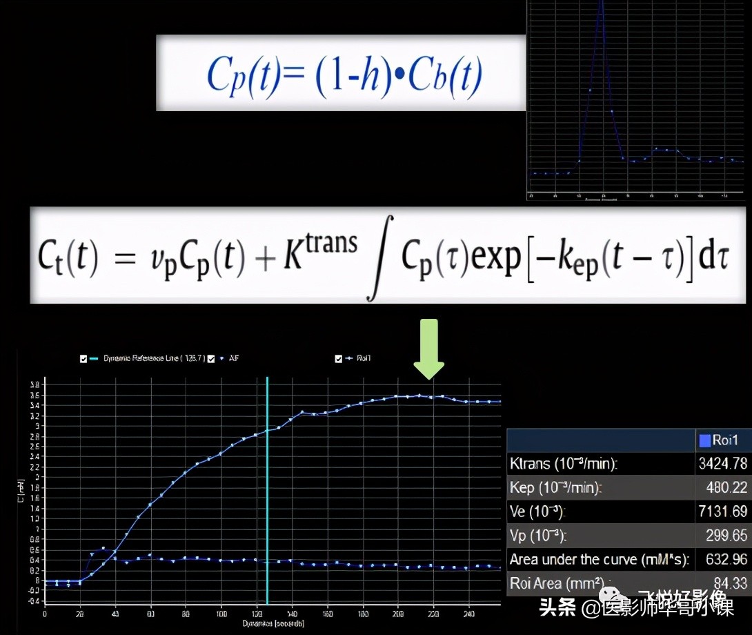 飞利浦磁共振系统界面及操作流程,飞利浦磁共振技术学习
