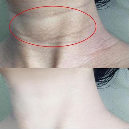 眼膜到底有没有用,眼膜用了洗不洗