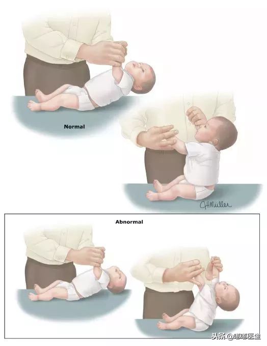 宝宝爱攥拳头是怎么回事,宝宝双臂向后使劲是肌张力高么