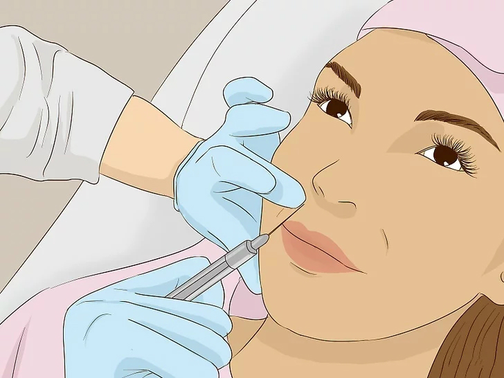 如何去除笑纹,表情纹跟笑纹怎么去除