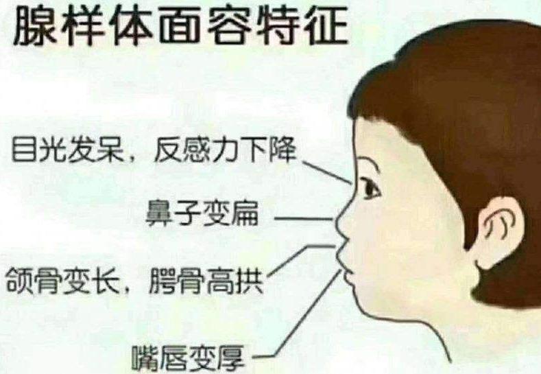 打呼噜影响到了室友会被孤立吗,怎么治室友打呼噜