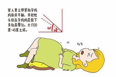 孕妈妈破水后需要注意什么呢,孕妇孕晚期怎么防止破水