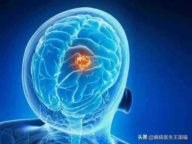 脑肿瘤引起的癫痫该怎么治愈,脑肿瘤引起的癫痫病能治愈吗