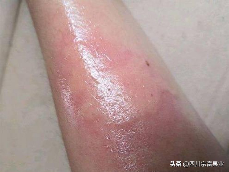 梨树上出现黄色层是什么病,梨树树干出现黄色层是什么病