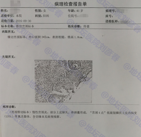 锥切后持续感染hpv如何治疗,宫颈活检2级病变感染多久了