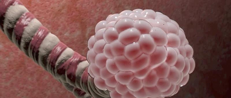 哮喘过敏症的症状,呼吸道过敏哮喘症状