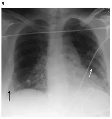 胸部影像解剖图谱书,胸部断层图谱