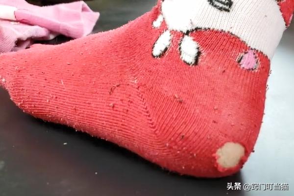 袜子破洞怎么补看不出来,袜子破了个洞怎么补无痕修复