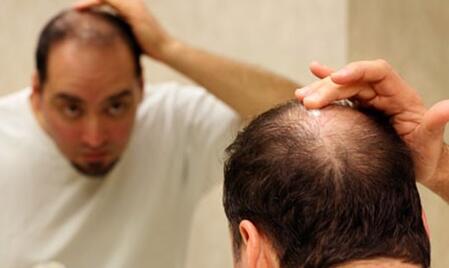 天津美丝特科技增发中心韩医生讲述织发补发的固定方式