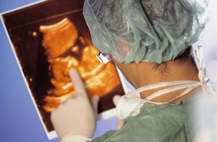 羊水破了保胎要注意什么,羊水破了如何避免胎儿宫内窘迫