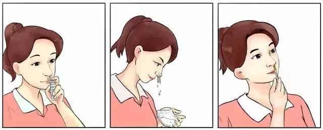 医生说宝宝是轻微鼻炎怎么办,婴儿鼻塞医生说呼吸道感染