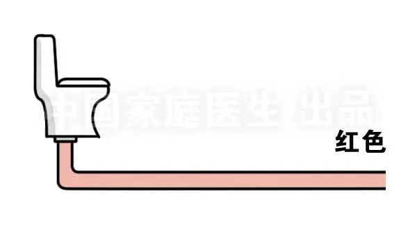 上厕所有四个症状说明肝有问题,上厕所时肾有刺痛是怎么回事