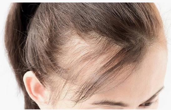 毛囊萎缩退化会脱发？教你三个方法，判断毛囊是否还活着