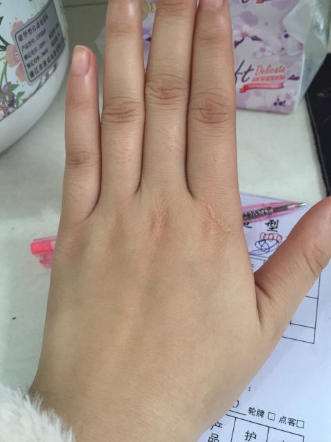 维嘉肤色黑,维嘉郁美净