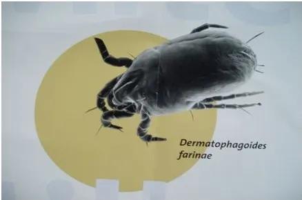 湿疹会引起流鼻涕吗,小孩流鼻涕嘴角湿疹