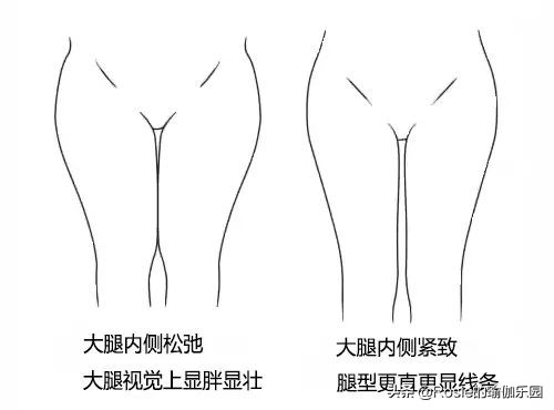 大腿上的肉肉怎么捏,大腿肉一捏好多凹凸不平怎么回事