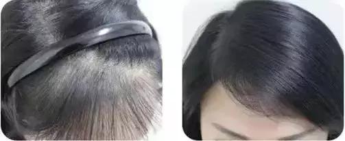 用什么洗发才能变得乌黑闪亮,用什么洗发水能让头发浓密乌黑