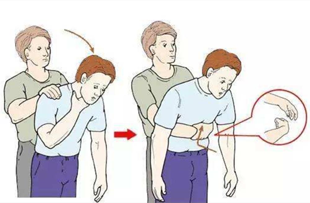 宝宝误食少量干燥剂怎么办,宝宝误食干燥剂会怎样